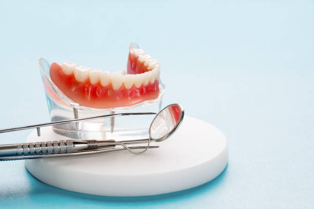 Dental Inlays and Onlays in Merritt Island, FL